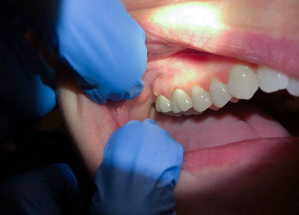 Best Pediatric Emergency Dentist in Forest Park, GA