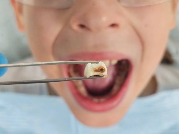 Best Emergency Dental Surgery in Forest Park, GA