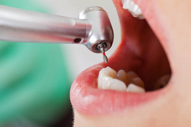Best After-Hours Emergency Dentist in Forest Park, GA